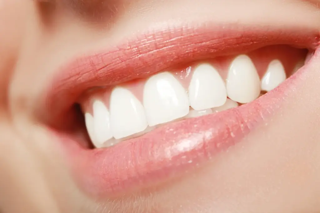 White teeth close up after cosmetic dentistry